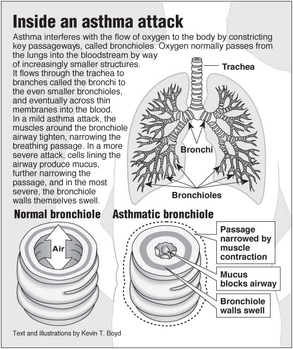 Inside an asthma attack